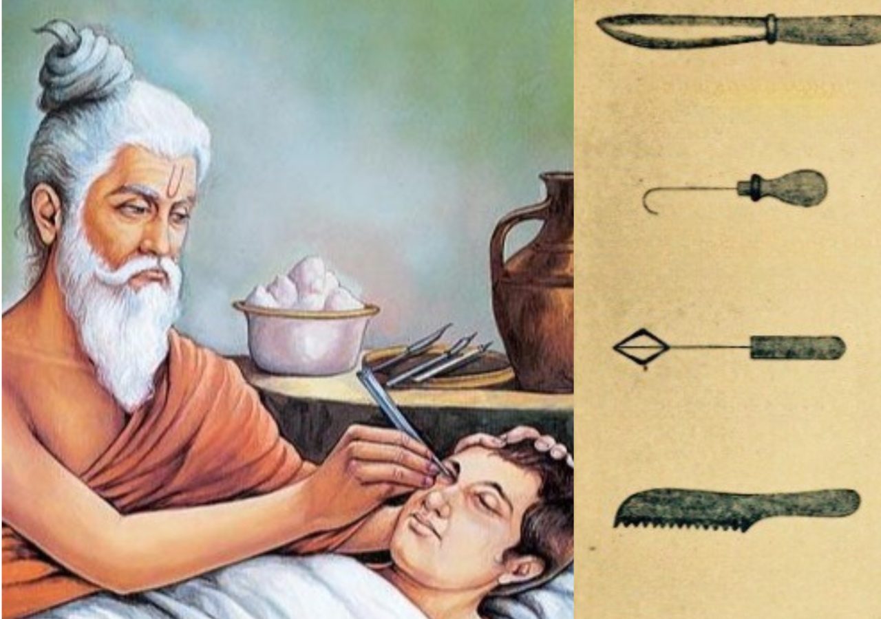 PIONEERS OF THE MIND: A HISTORY OF INDIAN NEUROSURGERY FROM SUSRUTA TO TODAY